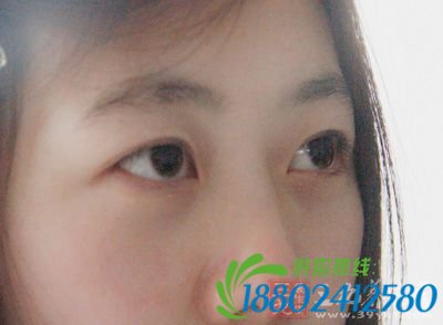 指压位于眼球正中央下2厘米处的&ldquo;四白&rdquo;