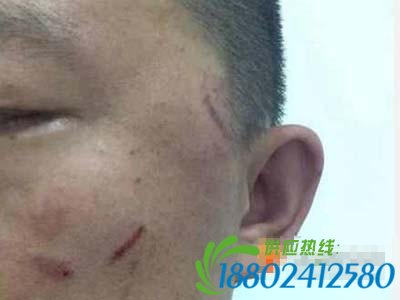 体坛路怒一族：王治郅拳打脚踢，孔令辉因此退