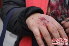 郑州摩的司机路边等客被蹭到 张嘴骂人咬人还打