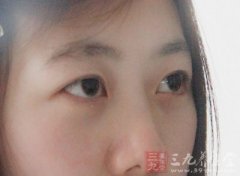 色盲能治好吗 这样治疗色盲病比较好