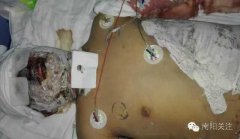 “南阳油罐车爆炸”续：有一大学生伤情严重急